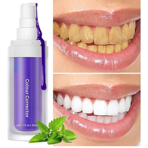 PureSmile – La pureza de una sonrisa blanca y perfecta.