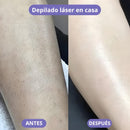 Depiladora Láser: Depilación Sin Dolor e Irritación 🌸