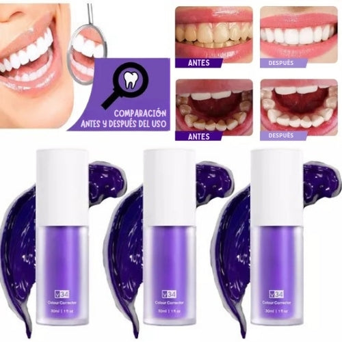 PureSmile – La pureza de una sonrisa blanca y perfecta.