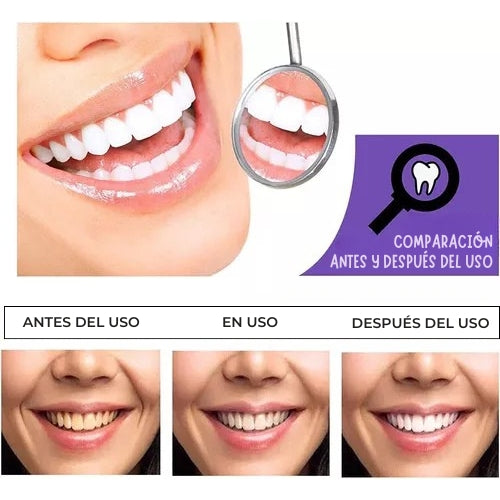 PureSmile – La pureza de una sonrisa blanca y perfecta.